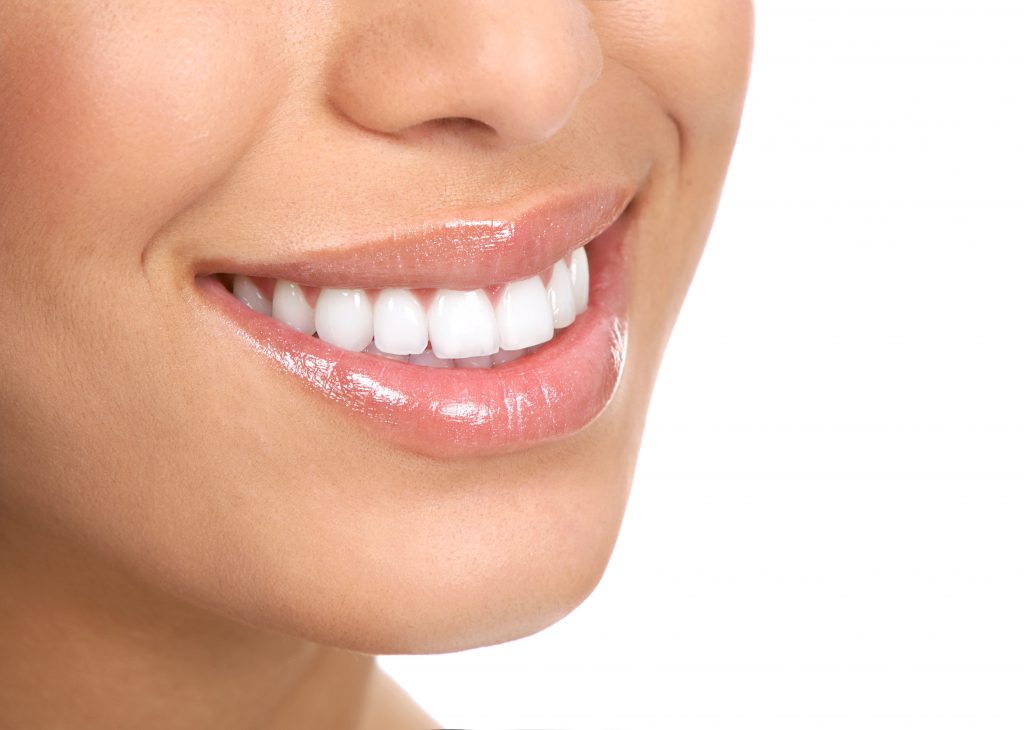 Veneers Stone Post Family Dental Overland Park, KS